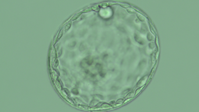 Blastosist- Blastokist Embriyo nedir? Blastokist  Embriyonun tutunma şansı nedir?