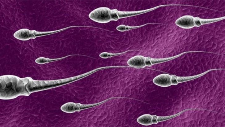 Sperm Analizi, Morfoloji ve Kruger testi