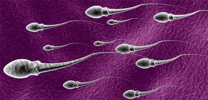 Sperm Analizi, Morfoloji ve Kruger testi
