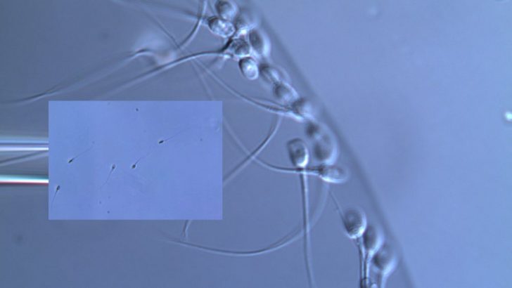 Sperm seçiminde Mikrocip ile IMSI arasındaki fark nedir ? Prof.Dr.Şahin Zeteroğlu