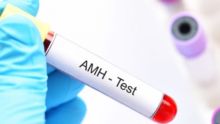 AMH testi Anti Müllerian Hormonu