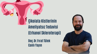 Çikolata Kistlerinin Ameliyatsız Tedavisi: Etanol Skleroterapi